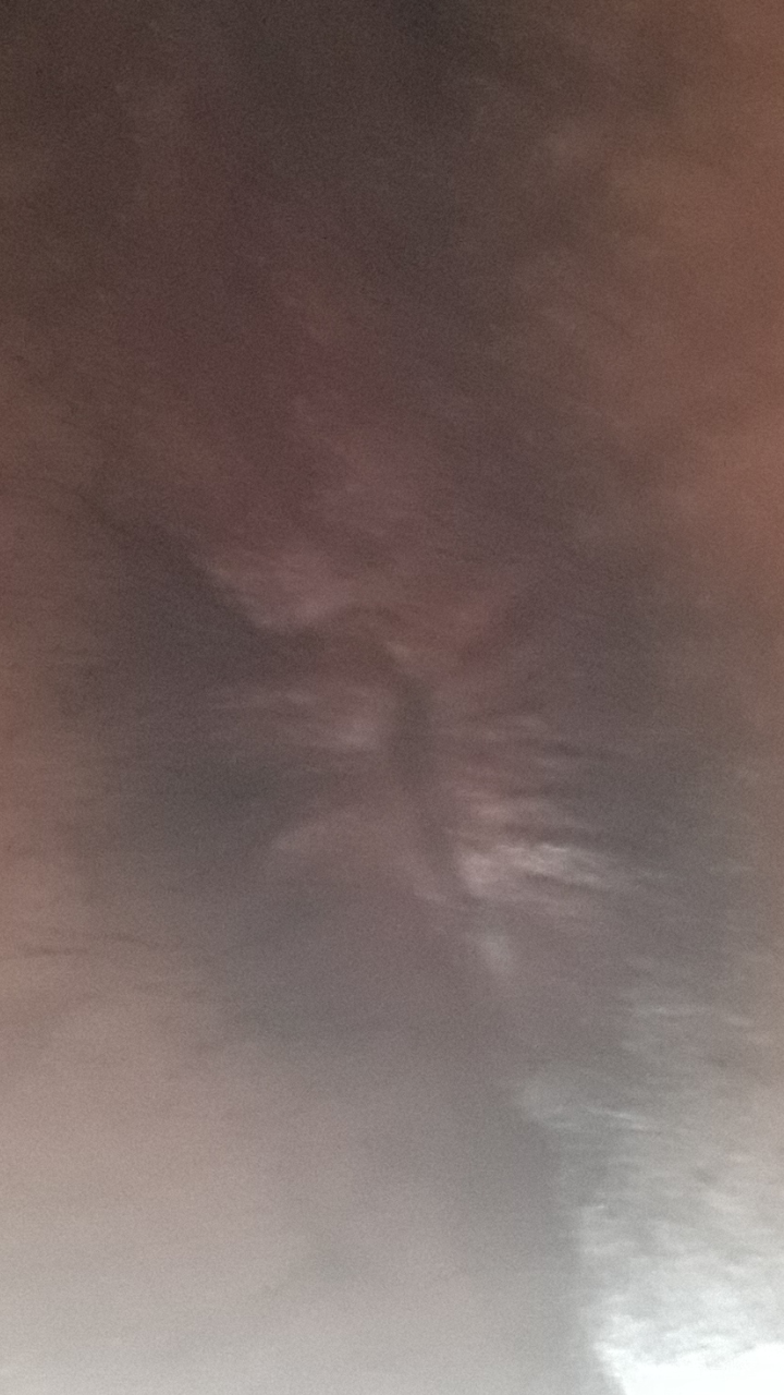 극혐주의)!!!!!!!!!!!!!!!!!!! 똥구멍 사진 이거 치질이냐 | 짤방 | 일베저장소